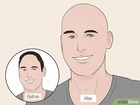 Navigating Confidence Loss Due to Baldness: Strategies and Insights